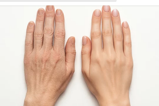 手や指のしわのケア